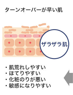 ザラザラ肌
