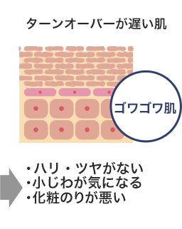 ゴワゴワ肌
