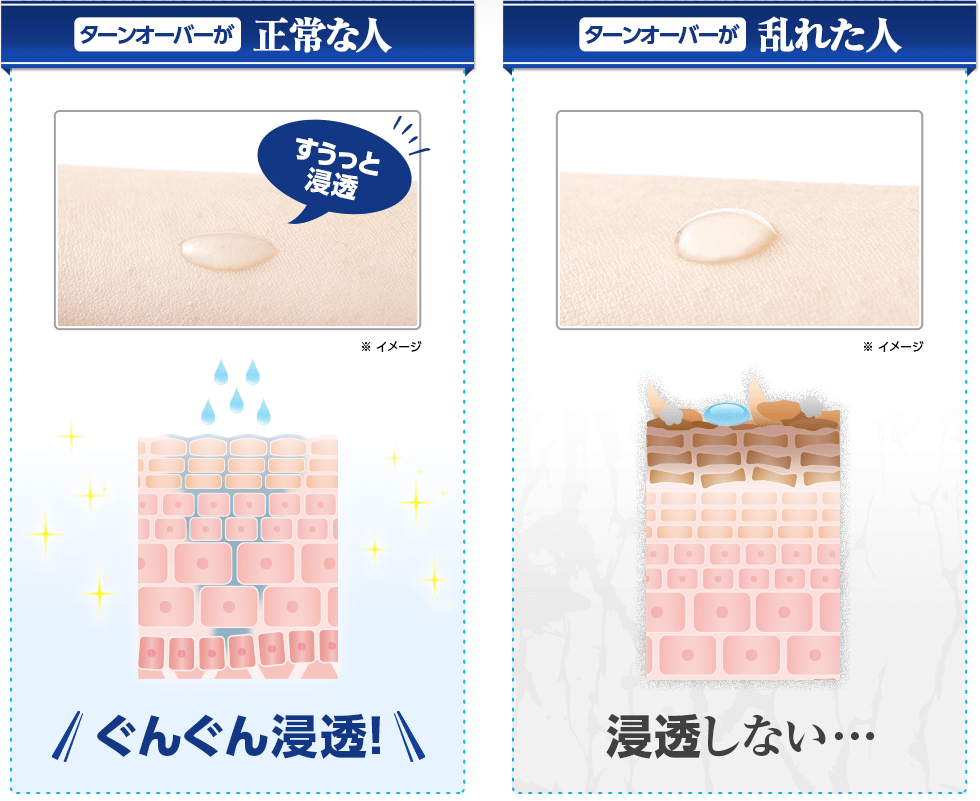 ターンオーバーが正常な人・乱れた人